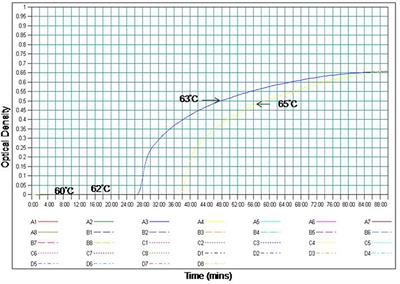 Polymerase Spiral Reaction Assay for Rapid and Real Time Detection of West Nile Virus From Clinical Samples